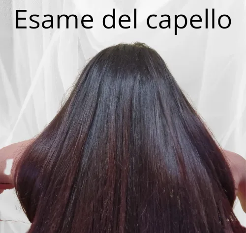 Tricologia — Analisi del capello — Farmacia del Quadrivio